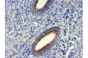 Image no. 3 for anti-Golgi Membrane Protein 1 (GOLM1) antibody (ABIN1498494) (GOLM1 抗体)