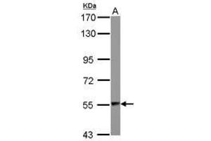 Image no. 2 for anti-Aspartyl-tRNA Synthetase (DARS) (AA 304-501) antibody (ABIN1497768) (DARS 抗体  (AA 304-501))