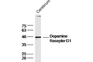 Mouse cerebrum lysates probed with DRD1 Polyclonal Antibody, unconjugated  at 1:300 overnight at 4°C followed by a conjugated secondary antibody at 1:10000 for 90 minutes at 37°C. (Dopamine Receptor d1 抗体  (AA 101-200))