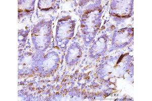 IHC analysis of BZW2 using anti-BZW2 antibody (ABIN7600608).
