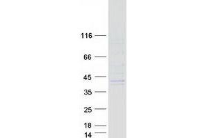 Validation with Western Blot