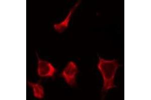 ABIN6268837 staining HepG2 by IF/ICC. (Galectin 9 抗体  (Internal Region))