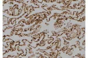 ABIN6273390 at 1/100 staining Human lung tissue by IHC-P.