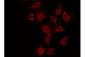 ABIN6269040 staining HeLa by IF/ICC. (SGK1 抗体  (C-Term))
