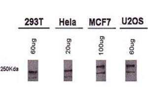 Western blot analysis of BRCA1 using BRCA1 monoclonal antibody, clone MU . (BRCA1 抗体  (AA 1314-1864))