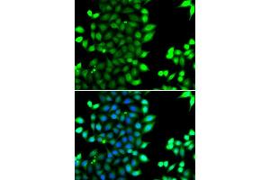 Immunofluorescence analysis of MCF7 cell using RNF7 antibody. (RNF7 抗体)