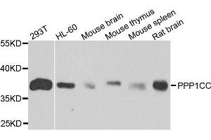 Western blot analysis of extracts of various cell lines, using PPP1CC antibody. (PPP1CC 抗体  (AA 1-323))