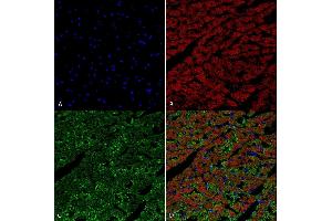 Immunohistochemistry analysis using Mouse Anti-Hexanoyl-Lysine adduct Monoclonal Antibody, Clone 5D9 (ABIN5067246). (Hexanoyl-Lysine Adduct (HEL) 抗体 (Biotin))