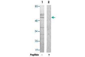 Western blot analysis of extracts from 293 cells, using IP6K3 polyclonal antibody . (IP6K3 抗体)