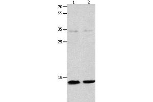 Western Blot analysis of Jurkat and 231 cell using MYL9 Polyclonal Antibody at dilution of 1:1500