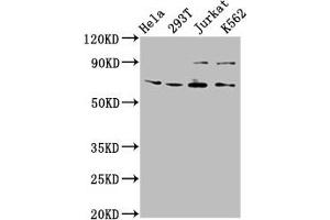 Western Blot Positive WB detected in: Hela whole cell lysate, 293T whole cell lysate, Jurkat whole cell lysate, K562 whole cell lysate All lanes: ALG9 antibody at 6. (ALG9 抗体  (AA 434-618))