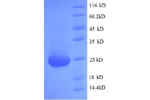 Fibroblast Growth Factor 23 (FGF23) (AA 25-251), (full length) protein (His tag)