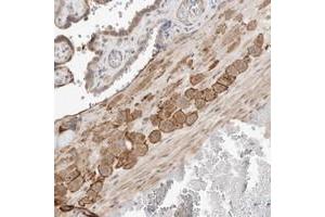 Immunohistochemical staining of human placenta with FLJ43582 polyclonal antibody  shows strong membranous and cytoplasmic positivity in decidual cells at 1:20-1:50 dilution. (C8ORF86 抗体)