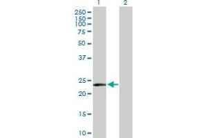 Western Blot analysis of MSRA expression in transfected 293T cell line by MSRA MaxPab polyclonal antibody. (MSRA 抗体  (AA 1-235))