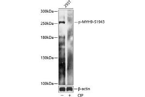 Western blot analysis of extracts of 293T cells, using Phospho-MYH9-S1943 antibody (ABIN7268744) at 1:2000 dilution. (Myosin 9 抗体  (pSer1943))