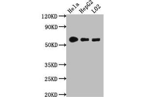 Western Blot Positive WB detected in: Hela whole cell lysate, HepG2 whole cell lysate, L02 whole cell lysate All lanes: CYP1A2 antibody at 1:1000 Secondary Goat polyclonal to rabbit IgG at 1/50000 dilution Predicted band size: 59 kDa Observed band size: 59 kDa (Recombinant CYP1A2 抗体)