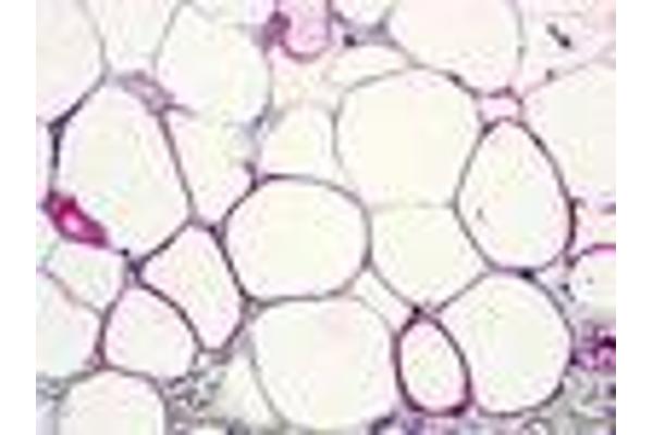 GPR77 抗体  (Extracellular Domain)