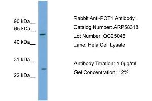WB Suggested Anti-POT1  Antibody Titration: 0. (POT1 抗体  (Middle Region))