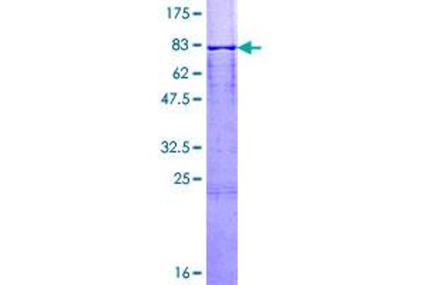 Calsequestrin Protein (AA 1-390) (GST tag)