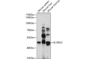 Western blot analysis of extracts of various cell lines, using IL13R antibody (043) at 1:1000 dilution. (IL13RA2 抗体  (AA 27-343))