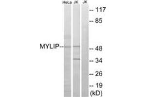Western blot analysis of extracts from HeLa/Jurkat cells, using MYLIP Antibody. (MYLIP 抗体  (AA 161-210))