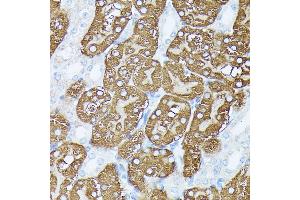 Immunohistochemistry of paraffin-embedded mouse kidney using PLS1 antibody (ABIN7269391) at dilution of 1:100 (40x lens). (PLS1 抗体  (AA 1-110))