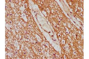 Immunohistochemistry (IHC) image for anti-Cytochrome P450, Family 7, Subfamily B, Polypeptide 1 (CYP7B1) (AA 312-430) antibody (ABIN7142186)
