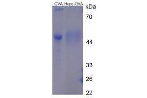 Image no. 1 for Hepcidin Antimicrobial Peptide (HAMP) peptide (Ovalbumin) (ABIN5666218) (Hepcidin Antimicrobial Peptide (HAMP) peptide (Ovalbumin))