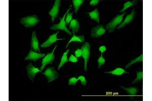 Immunofluorescence of monoclonal antibody to PBK on HeLa cell. (PBK 抗体  (AA 1-110))