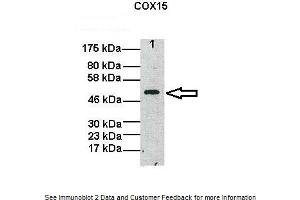 Lanes:   Lane1: 20ug human fibroblast mitochondria  Primary Antibody Dilution:   1:1000  Secondary Antibody:   Anti-Rabbit HRP  Secondary Antibody Dilution:   1:5000  Gene Name:   COX15  Submitted by:   Oleh Khalimonchuk, University of Nebraska-Lincoln (COX15 抗体  (N-Term))