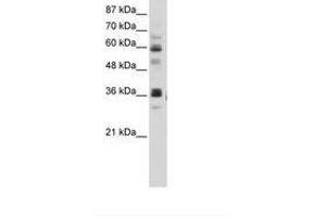 Image no. 2 for anti-RNA Pseudouridylate Synthase Domain Containing 2 (RPUSD2) (AA 201-250) antibody (ABIN202743) (RPUSD2 抗体  (AA 201-250))