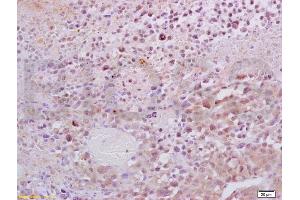 Formalin-fixed and paraffin embedded mouse lymphoma tissue labeled with Anti-Dnmt1 Polyclonal Antibody, Unconjugated (ABIN671796) at 1:200, followed by conjugation to the secondary antibody and DAB staining (DNMT1 抗体  (AA 21-120))