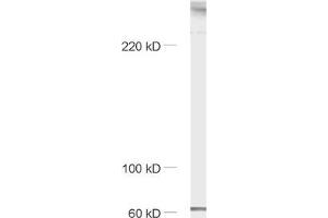 dilution: 1 : 1000, sample: mouse brain homogenate