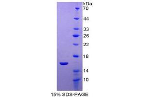 SDS-PAGE (SDS) image for Neuritin 1 (NRN1) (AA 28-142) protein (His tag) (ABIN2126039) (NRN1 Protein (AA 28-142) (His tag))