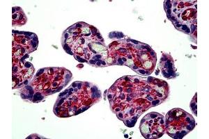 Human Placenta: Formalin-Fixed, Paraffin-Embedded (FFPE) (TUBA4A 抗体  (AA 426-450))