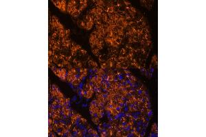 Immunofluorescence analysis of rat pancreas using SERPINI2 Polyclonal Antibody (ABIN6131321, ABIN6147617, ABIN6147618 and ABIN6215429) at dilution of 1:100 (40x lens). (SERPINI2 抗体  (AA 56-405))