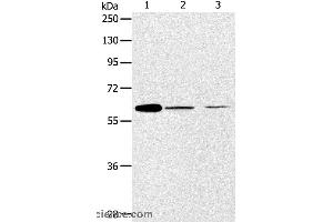 Western blot analysis of NIH/3T3 and SKOV3 cell, human ovarian cancer tissue, using ABCE1 Polyclonal Antibody at dilution of 1:450 (ABCE1 抗体)