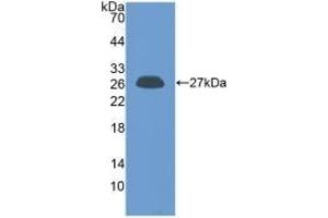Detection of Recombinant PRL, Human using Polyclonal Antibody to Prolactin (PRL) (Prolactin 抗体  (AA 29-227))