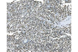 IHC analysis of Glycine decarboxylase/GLDC using anti-Glycine decarboxylase/GLDC antibody (ABIN7602073). (GLDC 抗体  (AA 574-1020))