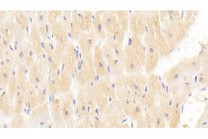 Detection of MX1 in Human Cardiac Muscle Tissue using Monoclonal Antibody to Myxovirus Resistance 1 (MX1) (MX1 抗体  (AA 80-342))