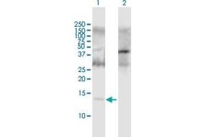 Western Blot analysis of APOC2 expression in transfected 293T cell line by APOC2 MaxPab polyclonal antibody. (Apolipoprotein C-II 抗体  (AA 1-101))