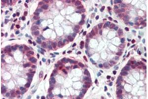 Immunohistochemistry (Paraffin-embedded Sections) (IHC (p)) image for anti-Transcription Factor 7-Like 1 (T-Cell Specific, HMG-Box) (TCF7L1) (AA 35-84) antibody (ABIN6741527)