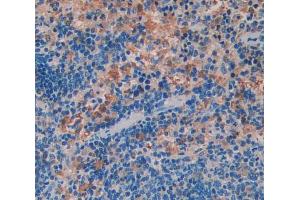 Used in DAB staining on fromalin fixed paraffin- embedded Kidney tissue (WASP 抗体  (AA 39-251))