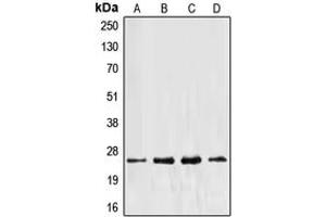 Western blot analysis of EEF1B2 expression in Jurkat (A), HeLa (B), MCF7 (C), A431 (D) whole cell lysates. (EEF1B2 抗体  (Center))