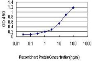 Detection limit for recombinant GST tagged CAMK1 is approximately 0. (CAMK1 抗体  (AA 271-370))