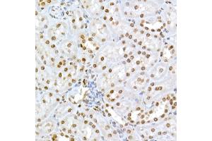 Immunohistochemistry of paraffin-embedded rat kidney using Phospho-RB-S795 Rabbit pAb (ABIN3023606, ABIN3023607, ABIN3023608 and ABIN6225464) at dilution of 1:50 (40x lens). (Retinoblastoma 1 抗体  (pSer795))