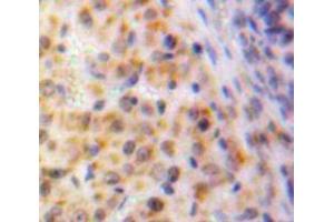 IHC-P analysis of Ovary tissue, with DAB staining. (EGR1 抗体  (AA 282-433))