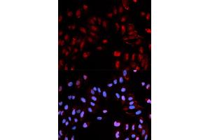 Immunofluorescence (IF) image for anti-Histone Cluster 1, H3b (HIST1H3B) (pSer29) antibody (ABIN1870230) (Histone H3.1 抗体  (pSer29))