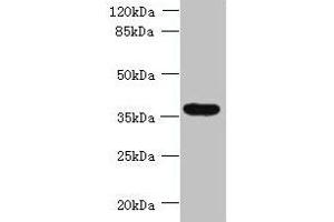 Western blot All lanes: TRIM51 antibody at 1. (TRIM51 抗体  (AA 160-452))