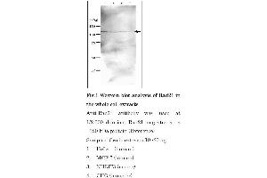 Western Blotting (WB) image for anti-RAD21 Homolog (RAD21) (C-Term) antibody (ABIN2452087) (RAD21 抗体  (C-Term))